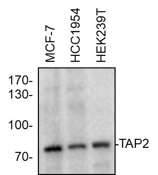 Human TAP2 Antibody MAB2432