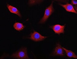 Human TAP2 Antibody MAB2432