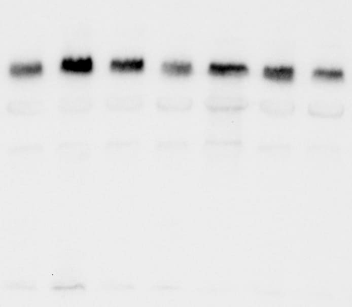 Human IFN‑ alpha / beta  R1 Antibody MAB245