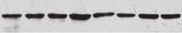 Human IFN‑ alpha / beta  R1 Antibody MAB245