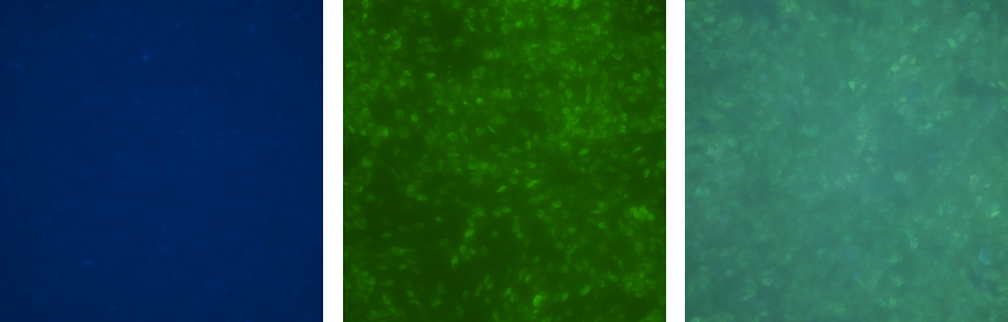 Human IL‑15 Antibody MAB2471