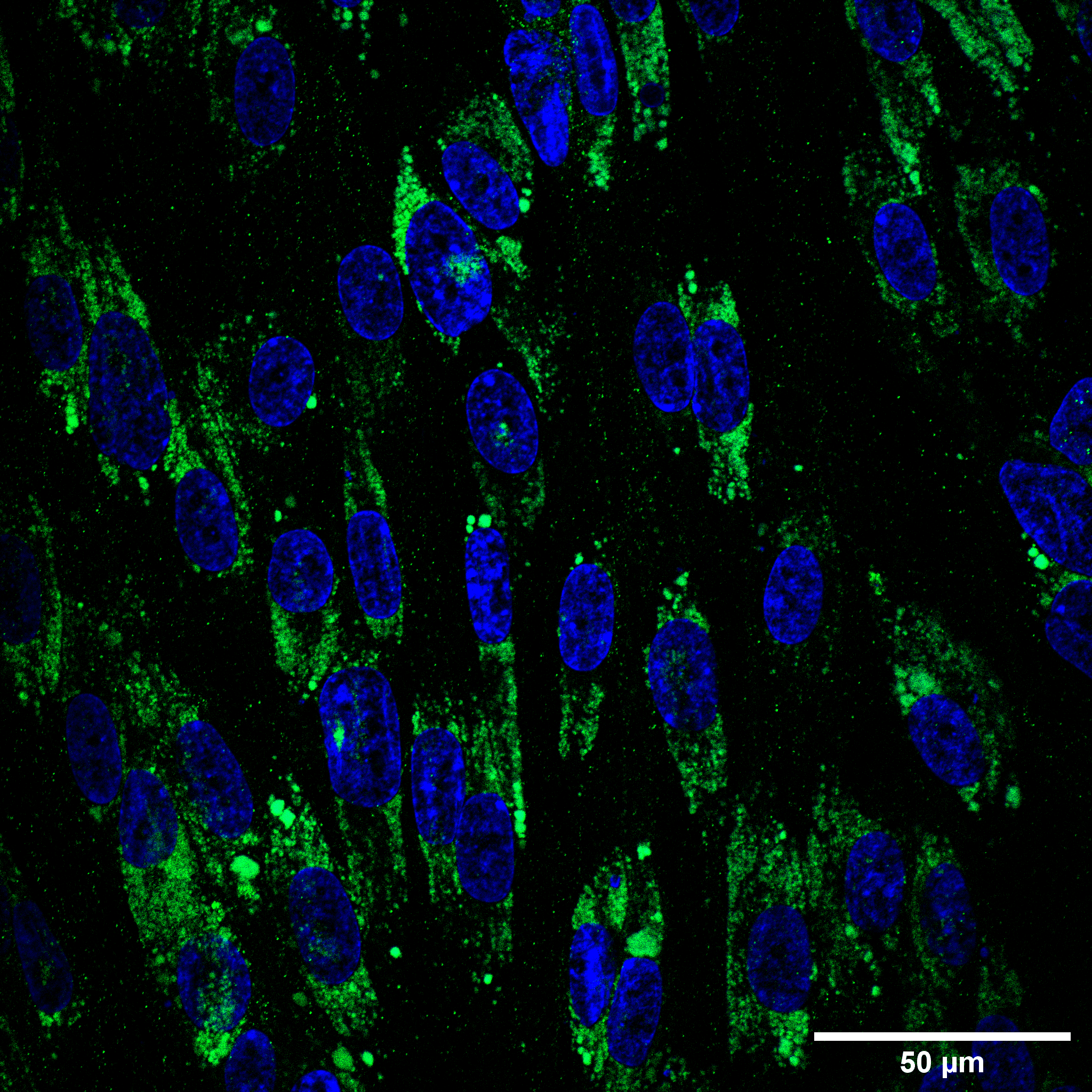 Human TfR (Transferrin R) Antibody MAB2474