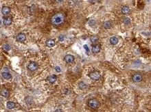 Human Plasma Kallikrein/KLKB1 Antibody MAB2497