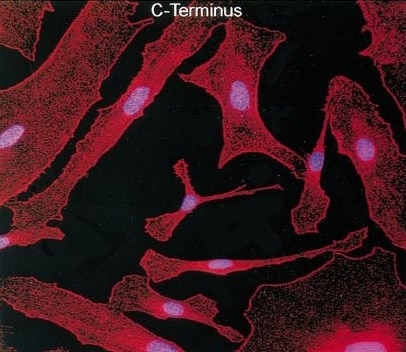 Human CFTR C-Terminus Antibody MAB25031