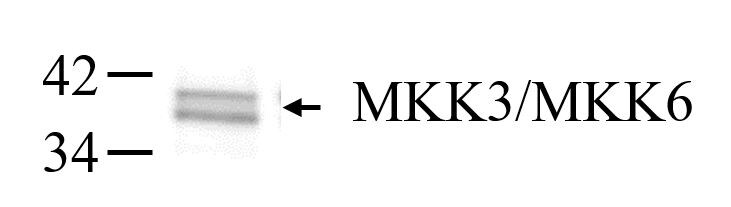 Human/Mouse/Rat MKK3/MKK6 Antibody MAB2514