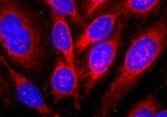 Human Pleiotrophin/PTN Antibody MAB252