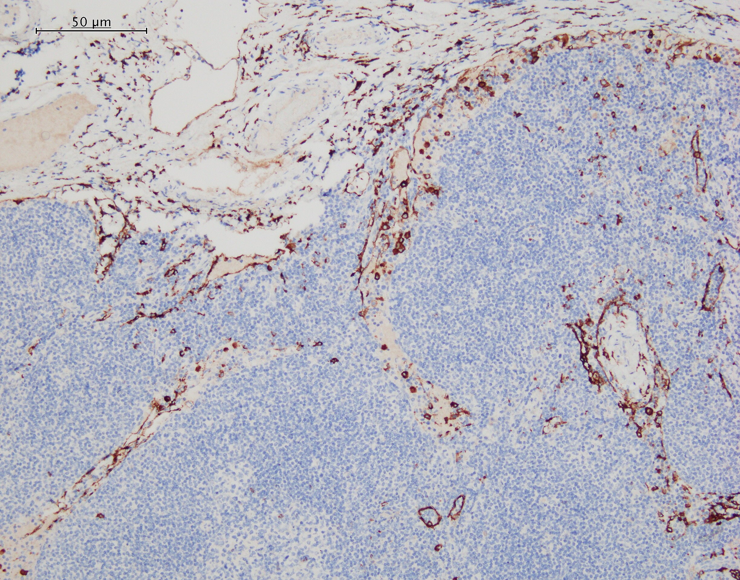 Human MMR/CD206 Antibody MAB25341