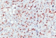 Human MMR/CD206 Antibody MAB25341