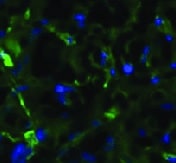 Human MMR/CD206 Antibody MAB2534