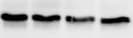 Human DDR2 Antibody MAB2538