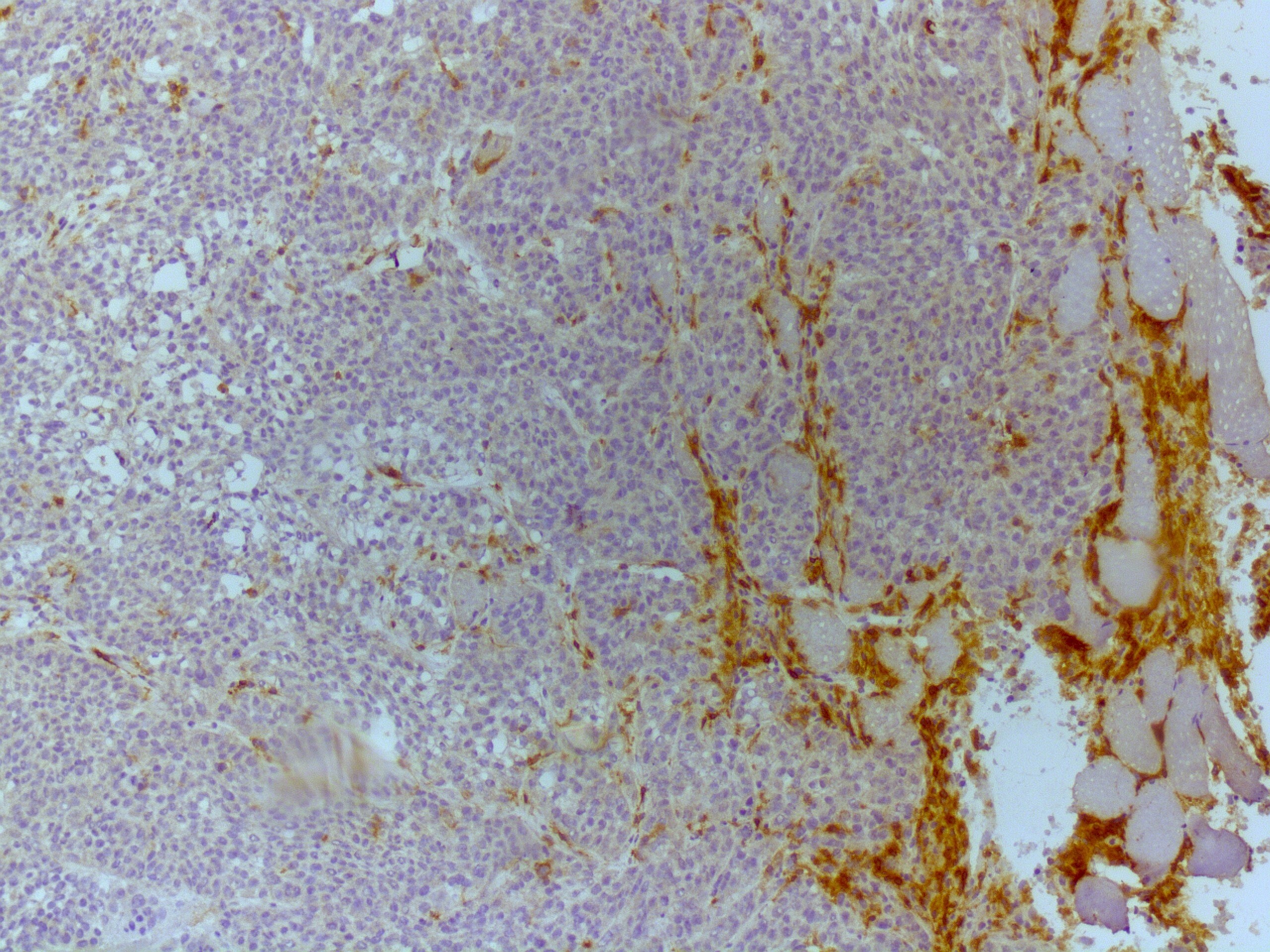Human CXCL5/ENA‑78 Antibody MAB254