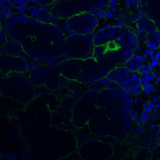 Human Nidogen‑1/Entactin Antibody MAB2570