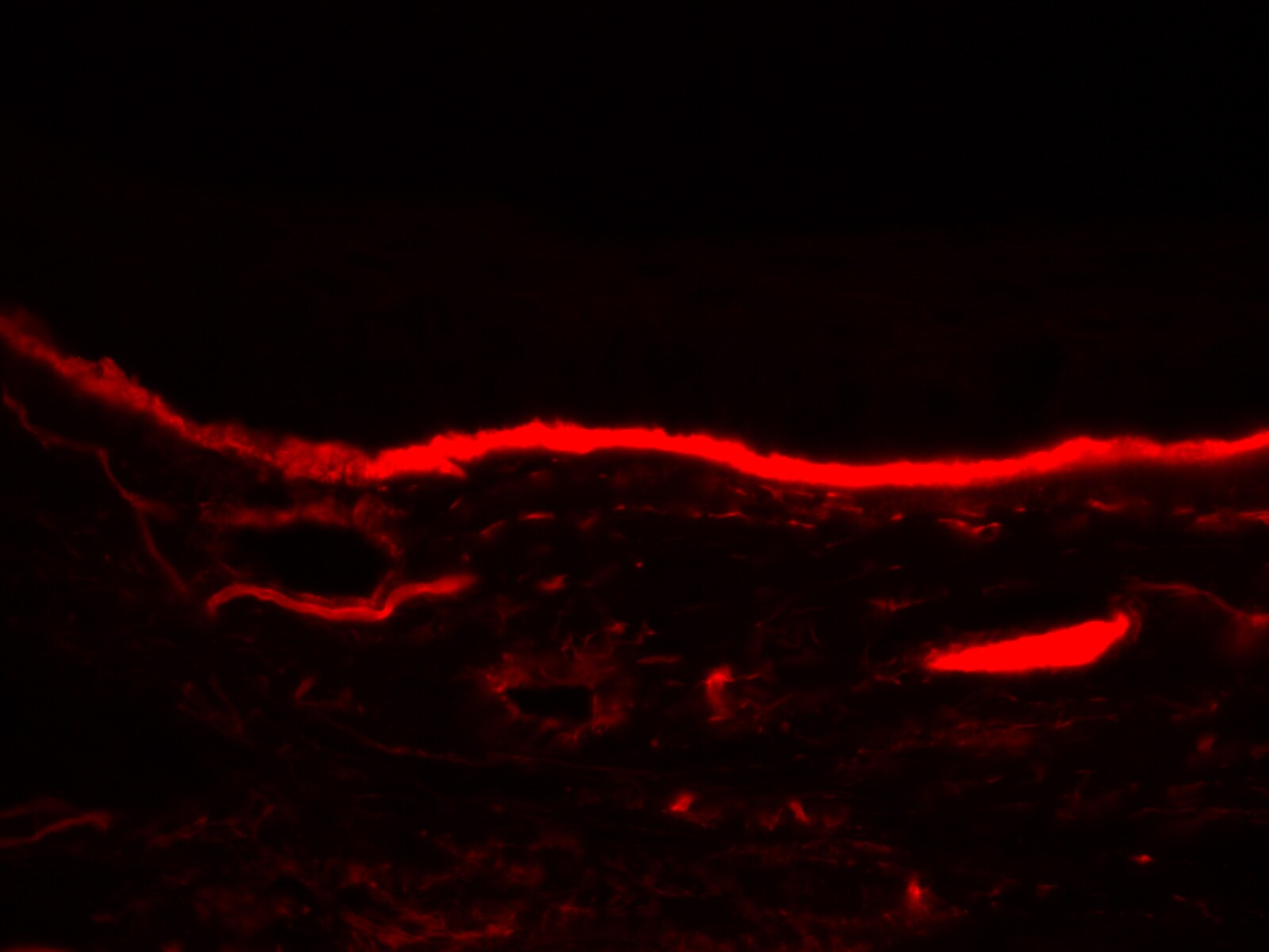 Human Nidogen‑1/Entactin Antibody MAB2570