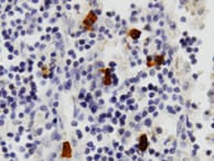 Human Midkine Antibody MAB2583