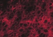 Human NG2/MCSP Antibody MAB2585