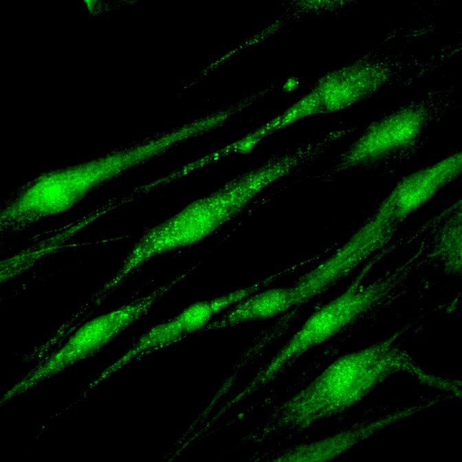 Human GFAP Antibody MAB2594