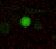 Human Plasminogen/Plasmin Antibody MAB2596