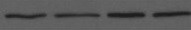 Human Cardiotrophin‑1/CT‑1 Antibody MAB260