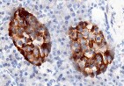 Human Betacellulin/BTC Antibody MAB2611