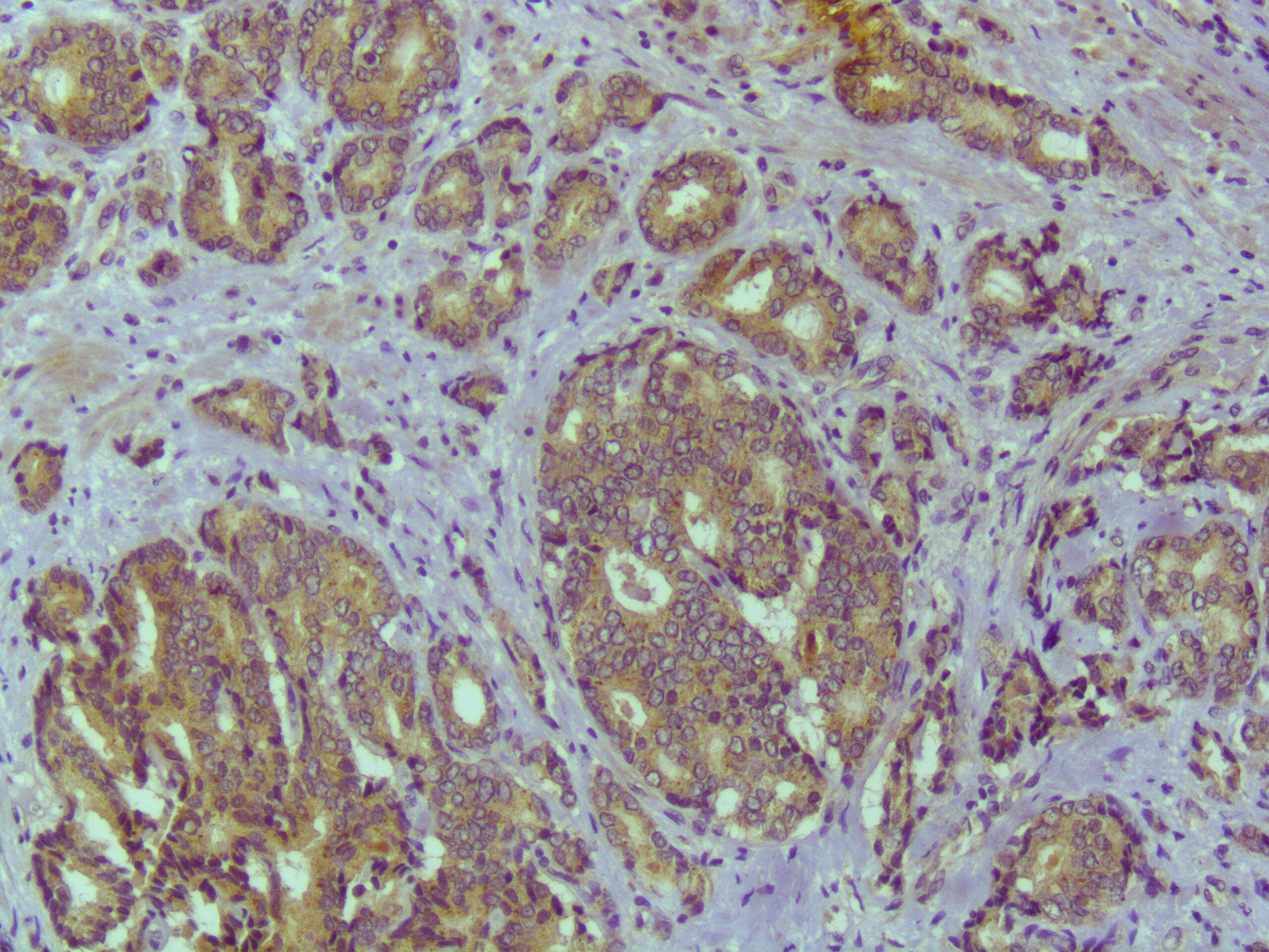 Human SHBG Antibody MAB26563