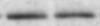Human SHBG Antibody MAB2656
