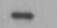 Human SHBG Antibody MAB2656