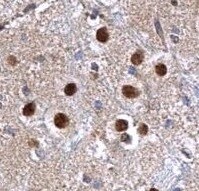 Human PTP beta / zeta /PTPRZ Antibody MAB26881