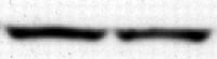 Human PTP beta / zeta /PTPRZ Antibody MAB2688