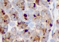 Human Cadherin‑6/KCAD Antibody MAB27151