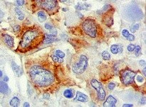 Human pIgR Antibody MAB27171