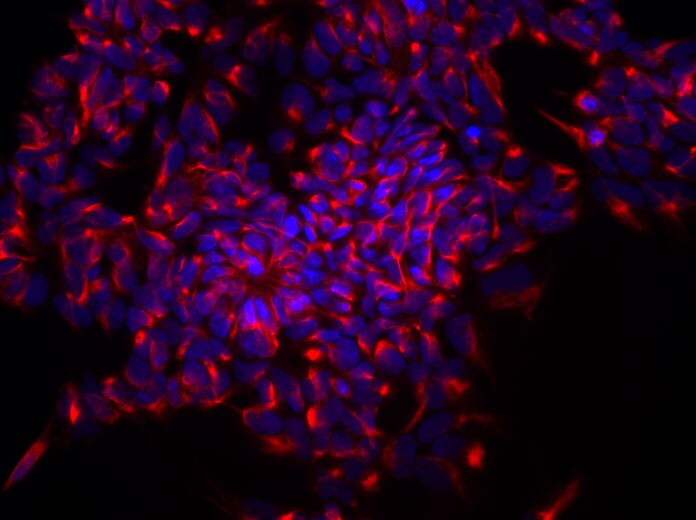 Mouse/Rat Nestin Antibody MAB2736