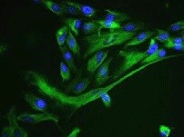 Mouse/Rat Nestin Antibody MAB2736