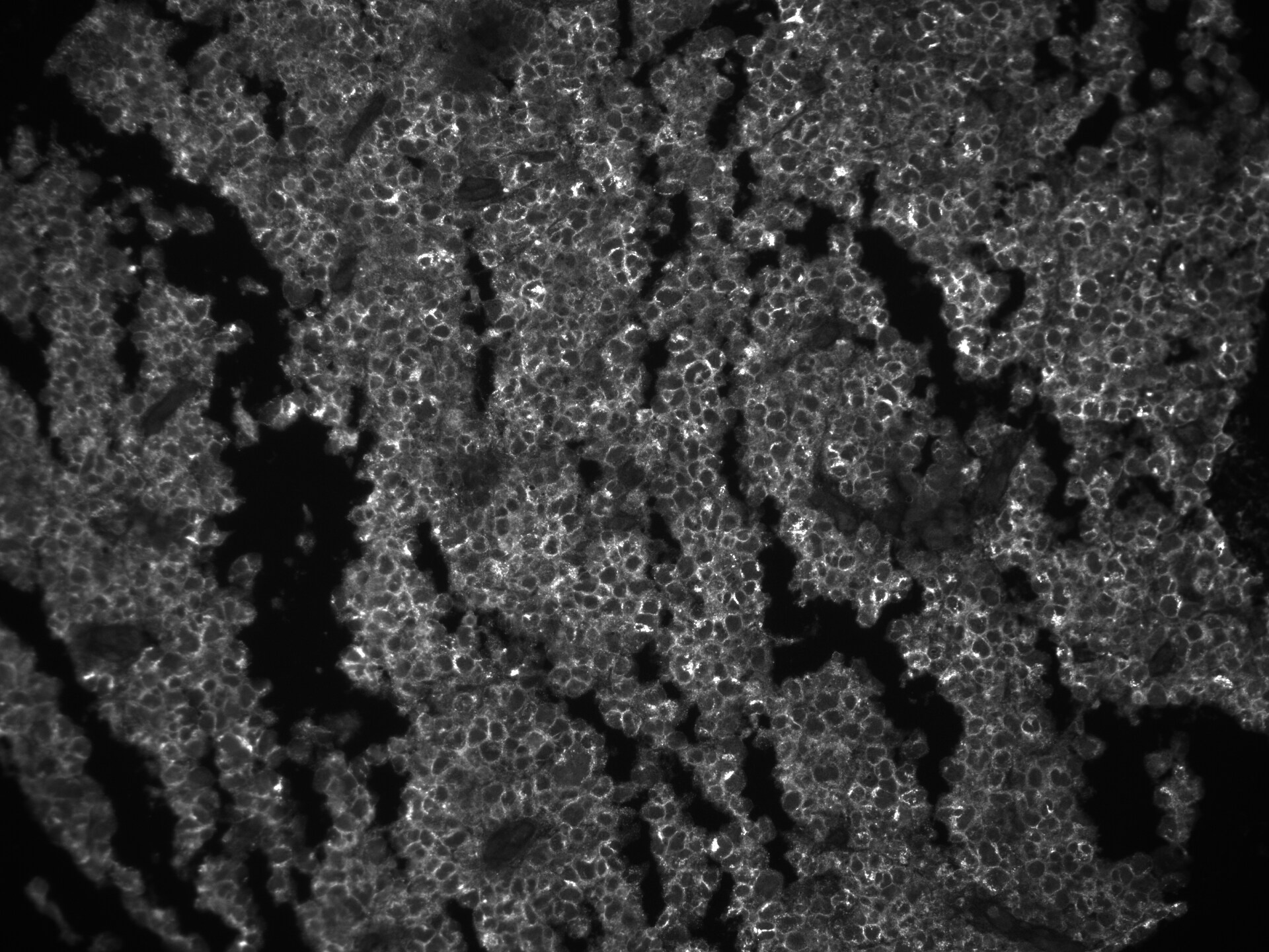 Human CD27 Ligand/TNFSF7 Antibody MAB2738