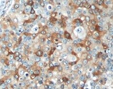 Mouse ASGR1/ASGPR1 Antibody MAB27552