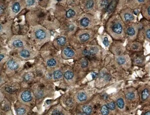 Mouse ASGR1/ASGPR1 Antibody MAB27552