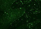 Human IL‑22 R alpha 1 Antibody MAB2770