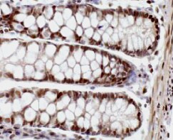 Human Syndecan‑1/CD138 Antibody MAB2780