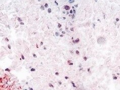 Human CCL2/JE/MCP‑1 Antibody MAB2791