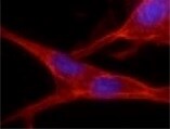Human Relaxin‑2 Antibody MAB28041