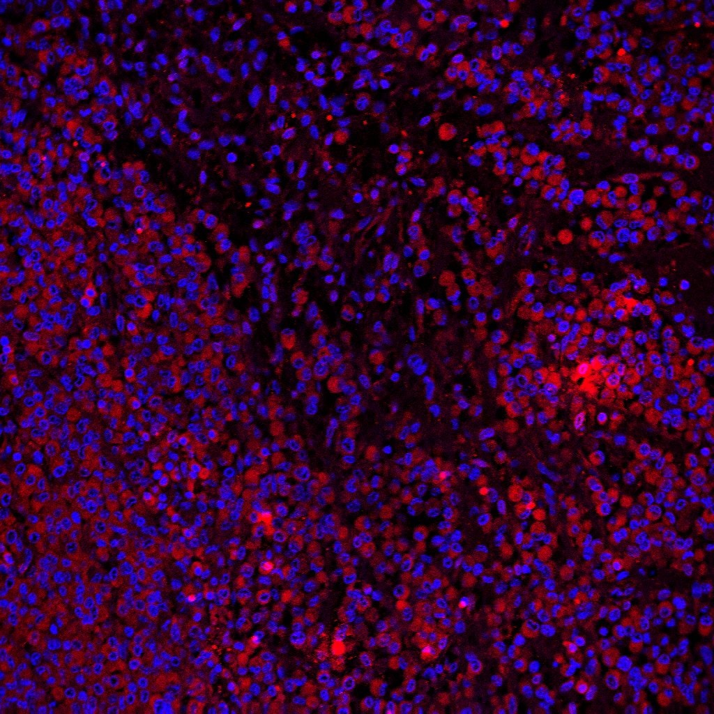 Human IFN‑ gamma  Antibody MAB2851