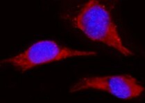 Human/Mouse/Rat MEK2 Antibody MAB2855