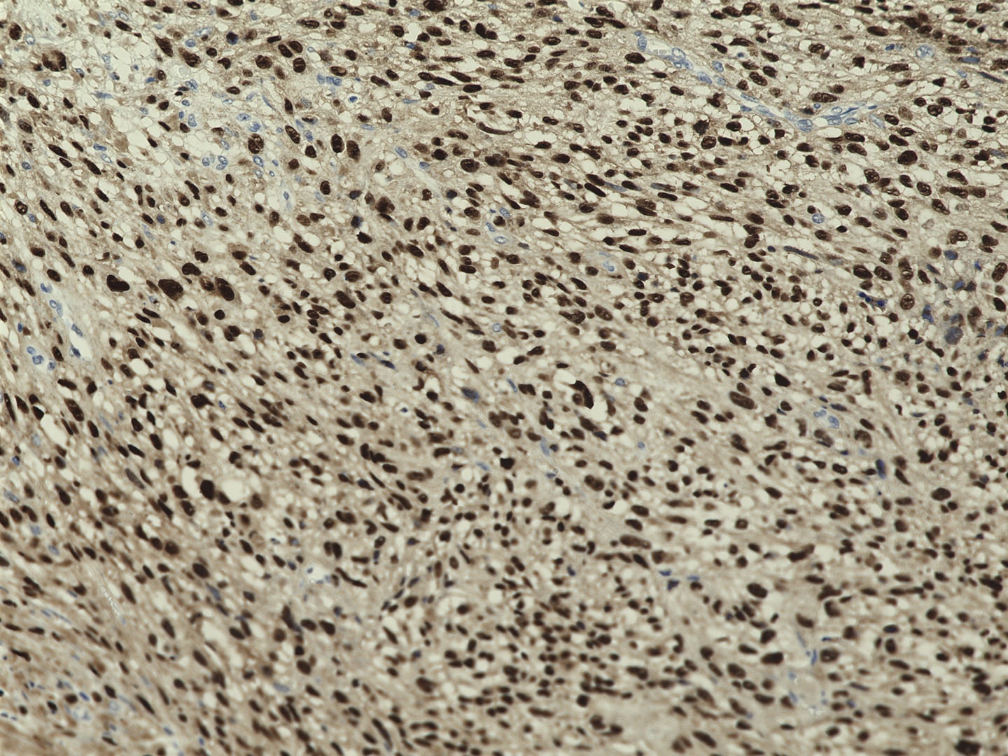 Human/Rat SOX10 Antibody MAB2864