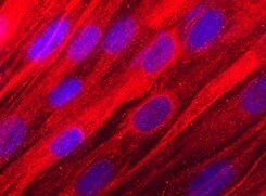 Human Osteoadherin/OSAD Antibody MAB2884