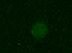 Human NFkB2 Antibody MAB28881