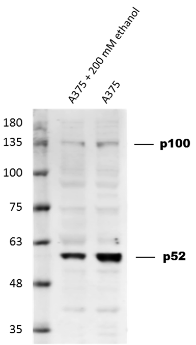 Human NFkB2 Antibody MAB28881