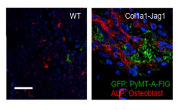 Human Alkaline Phosphatase/ALPL Antibody MAB29091