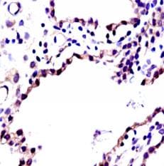 Human IGF-I/IGF-1 Antibody MAB291