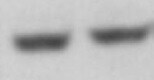 Human BMP‑15/GDF‑9B Antibody MAB2925