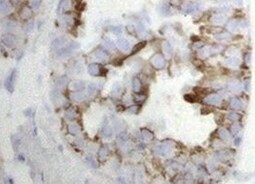 Human/Mouse/Rat FABP1/L‑FABP Antibody MAB2964