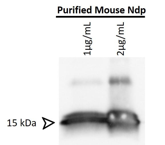 Human/Mouse Norrin Antibody MAB3014
